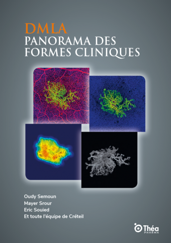 Capa DMLA Panorama des formes cliniques 