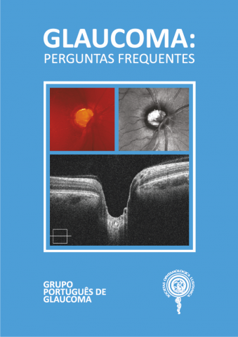 Capa Glaucoma: Perguntas frequentes