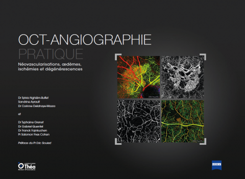 Capa OCT-Angiographie Pratique